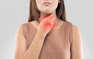 Hypothyroidism IBS e1593353380382