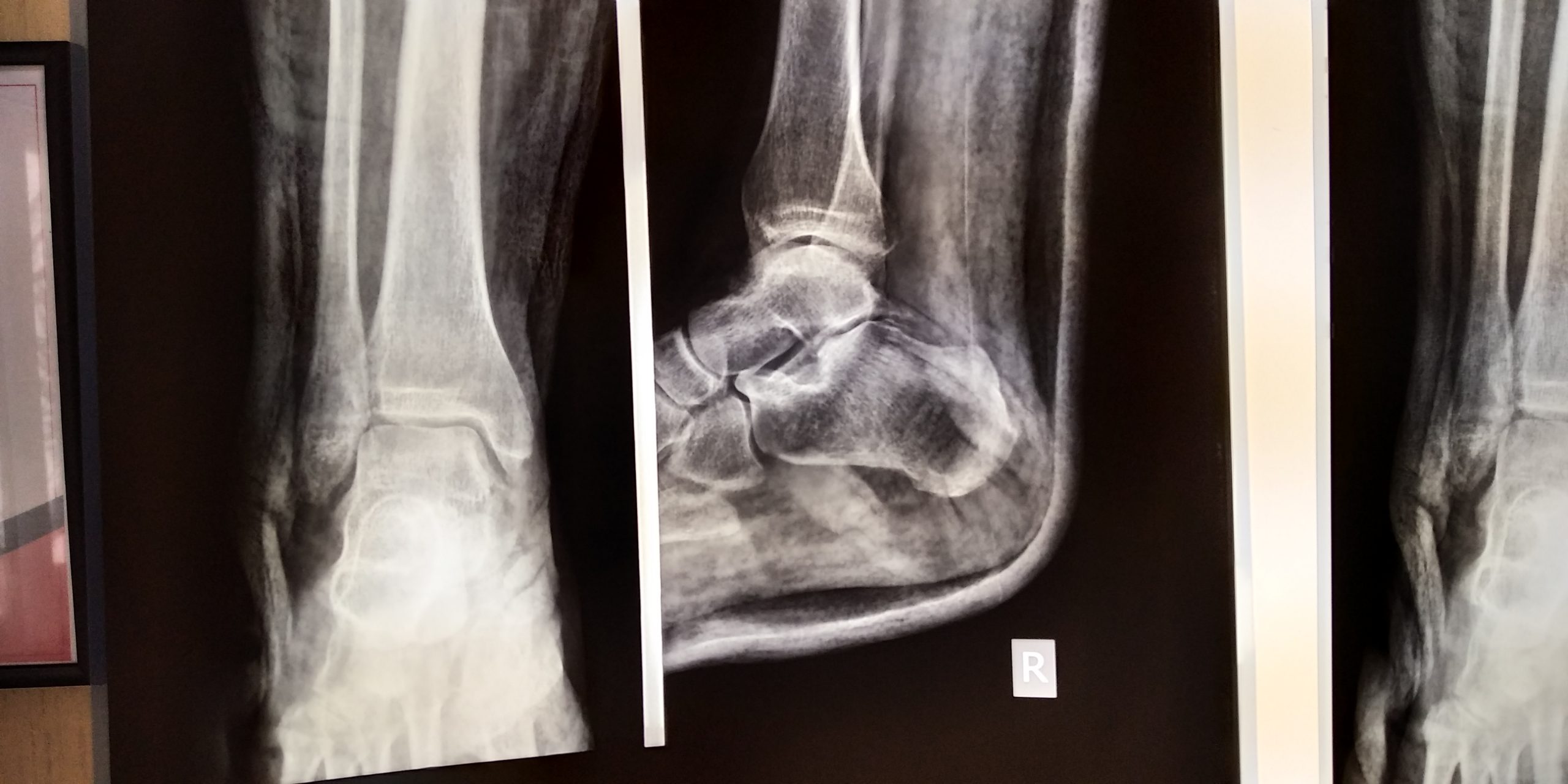 IMG 20200305 091108 scaled